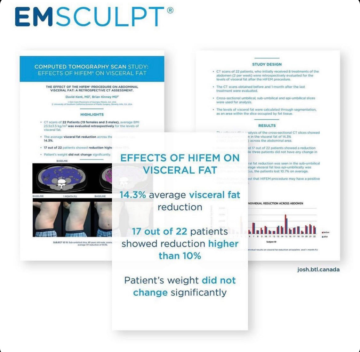 Three overlaying images, first image of male patient showing loss of visceral fat.  Second image of data that reads 14.3% average  visceral fat reduction, 17 out of 22 patients showed reduction higher than 10%, patient's weight did no change significantly; Third image of graph illustrates results and describes in part the study design.