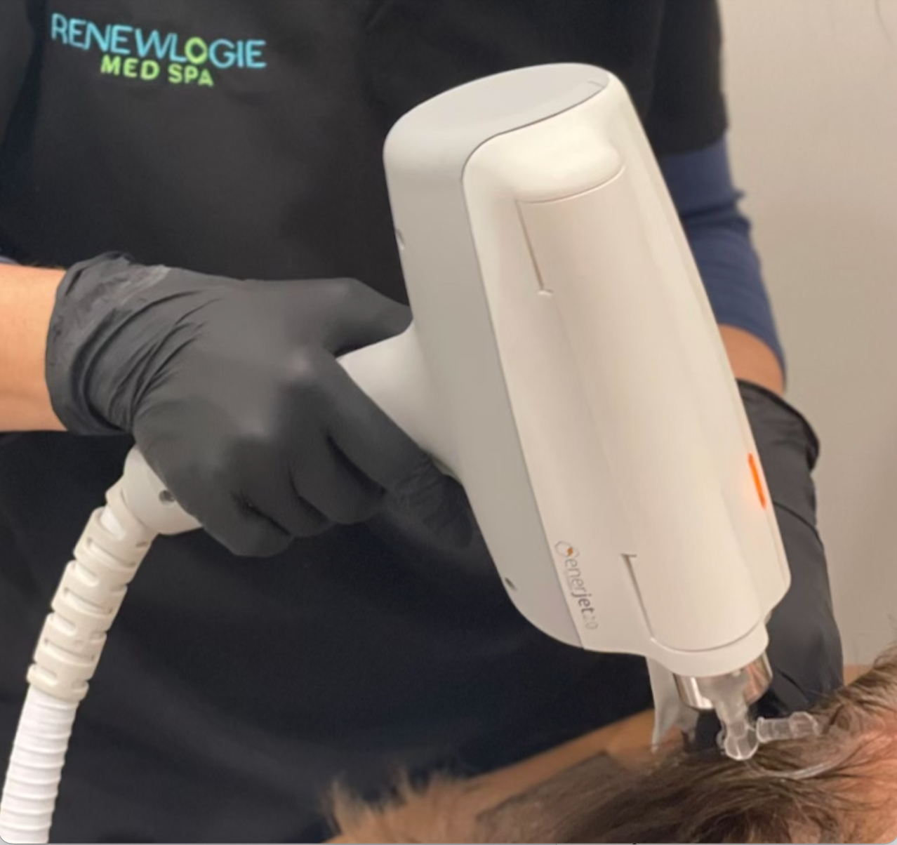 Enerjet kinetic facelift procedure with treatment in progress